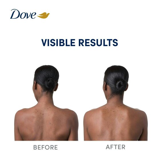 Dove Niacinamide Even Tone Body Serum with Vitamin C for Dark Spots, 12x200ml