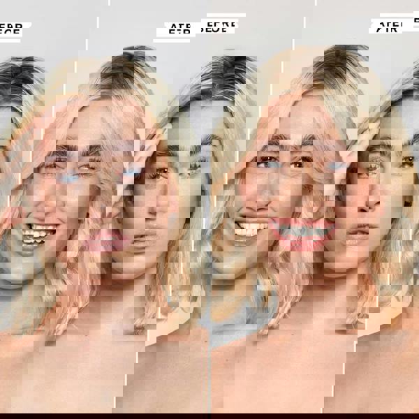 Philip Kingsley Flaky Itchy Scalp Toner Double