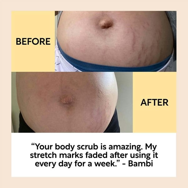 UpCircle Bodycare Bundle