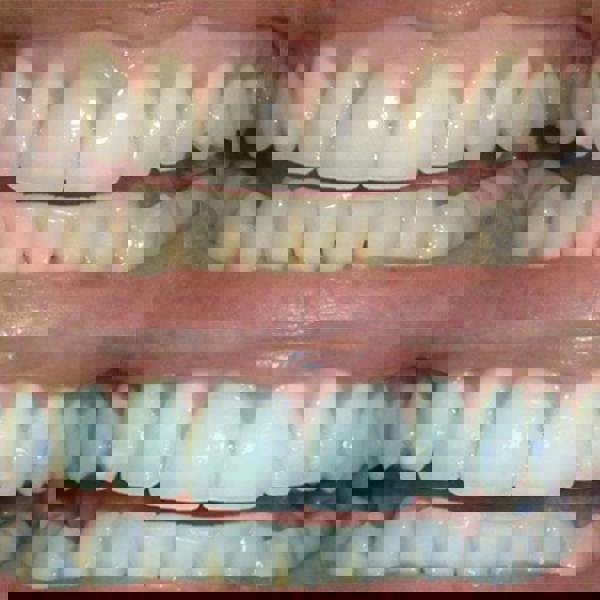 Smile Science Harley Street Harley Street Professional Foam Duo