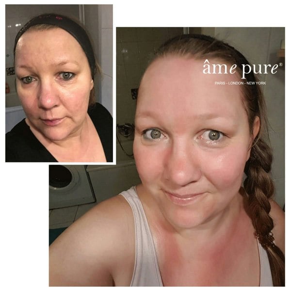 Âme Pure WRINKLERASER BASIC - Microneedling Derma Roller Kit