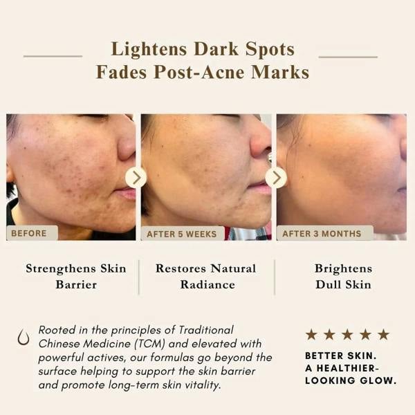 LUWIN Skincare Powerful Brightening & Rejuvenating Duo – Hyperpigmentation Cream & Brightening Serum Set | LUWIN