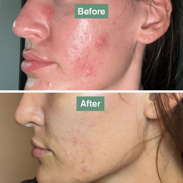Dr. Vegan Skin Saviour 60 caps