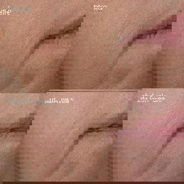 Dermalogica AGE Smart® Phyto-Nature Firming Serum