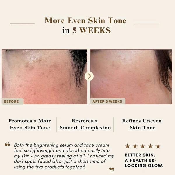 LUWIN Skincare Powerful Brightening & Rejuvenating Duo – Hyperpigmentation Cream & Brightening Serum Set | LUWIN