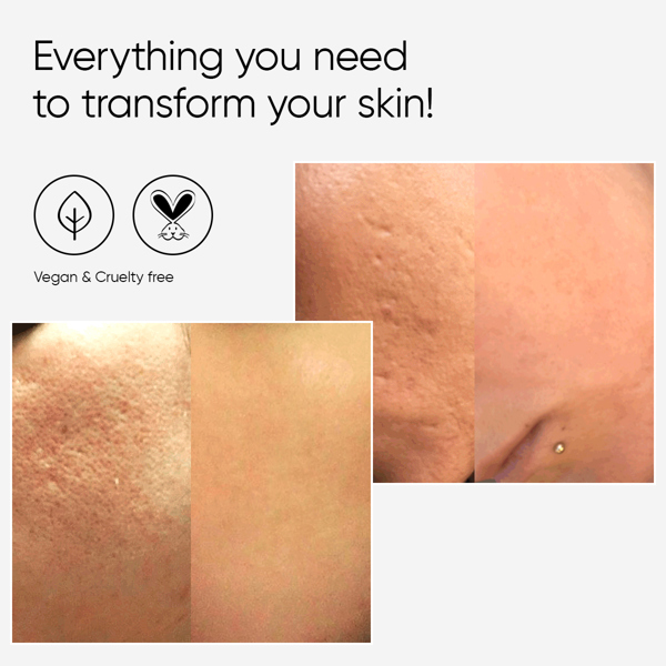 Âme Pure CIT FACE ROLLER BASIC 0.5 mm - Microneedling Derma Roller Kit