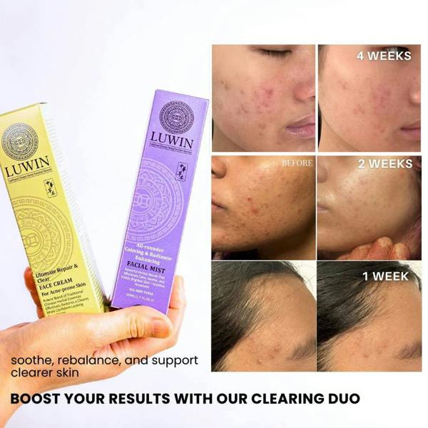 LUWIN Skincare Ultimate Repair & Clear Face Cream – Calming Acne Cream for Acne-Prone Skin | LUWIN