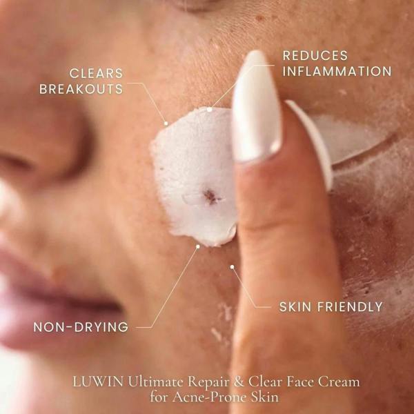 LUWIN Skincare Ultimate Repair & Clear Face Cream – Calming Acne Cream for Acne-Prone Skin | LUWIN