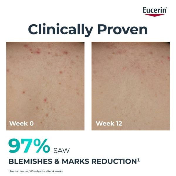 Eucerin DermoPure Clinical Correcting Body Cream 200ml - Additional 5