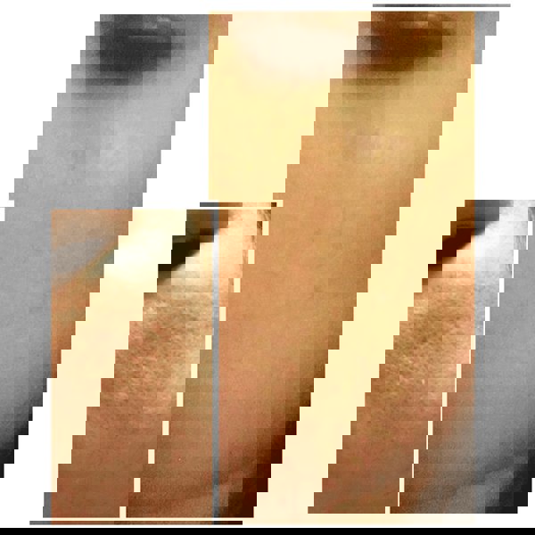 Âme Pure CIT FACE ROLLER PLATINUM - Microneedling Derma Roller Kit