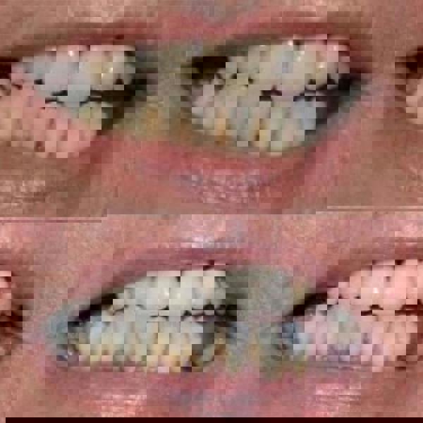 Smile Science Harley Street Vita-White Toothpaste