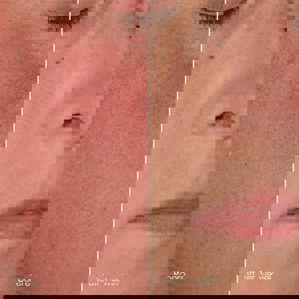 Dermalogica Stabilizing Repair Cream