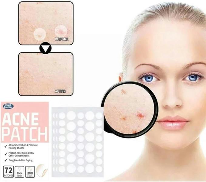 Dyzi 72 Invisible Acne Patch Pimple Stickers For Zits & Blemishes