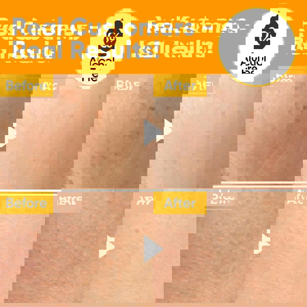 Âme Pure C-BRIGHTER DAYS  - Vitamin C & Fruit Extracts I Brightening Toner For Face