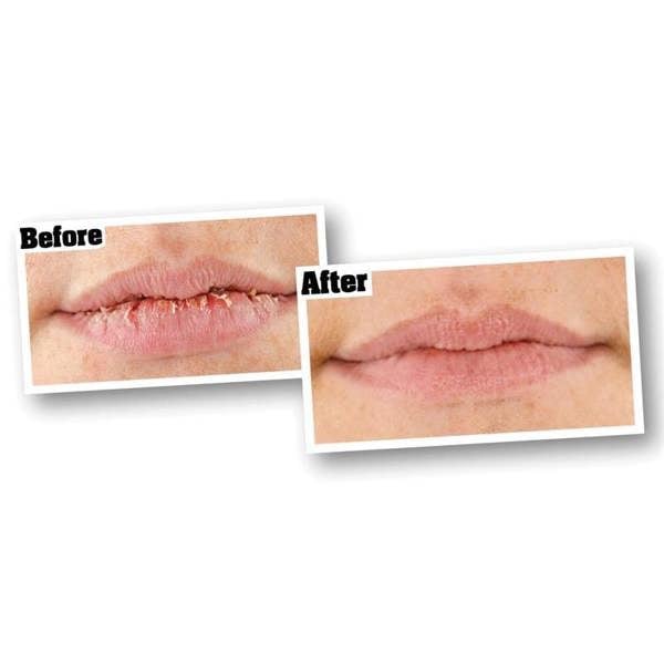 Gorilla Glue O'keeffe's Lip Repair Lip Balm - Multi Colour - 