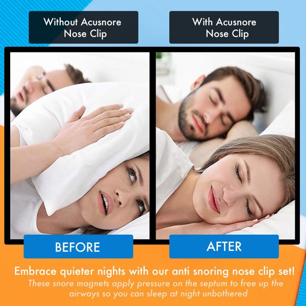 Acusnore Anti Snore Snoring Kit (Anit Snore Ring, Mouthpiece & Nose Clip)