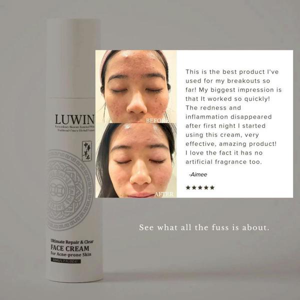 LUWIN Skincare Advanced Calming & Clear Duo – Acne Cream & Calming Mist Set for Clear Skin | LUWIN