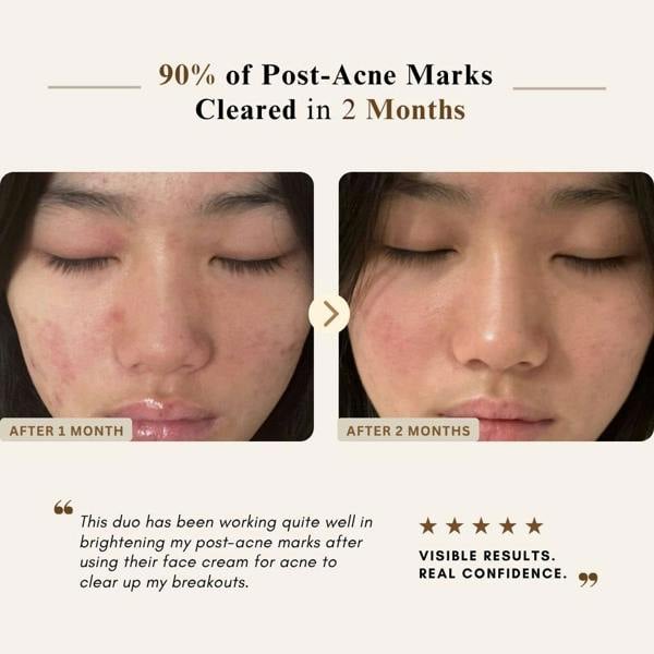 LUWIN Skincare Ultimate Brightening & Rejuvenating Complete Set – Full Hyperpigmentation & Dark Spot Routine | LUWIN