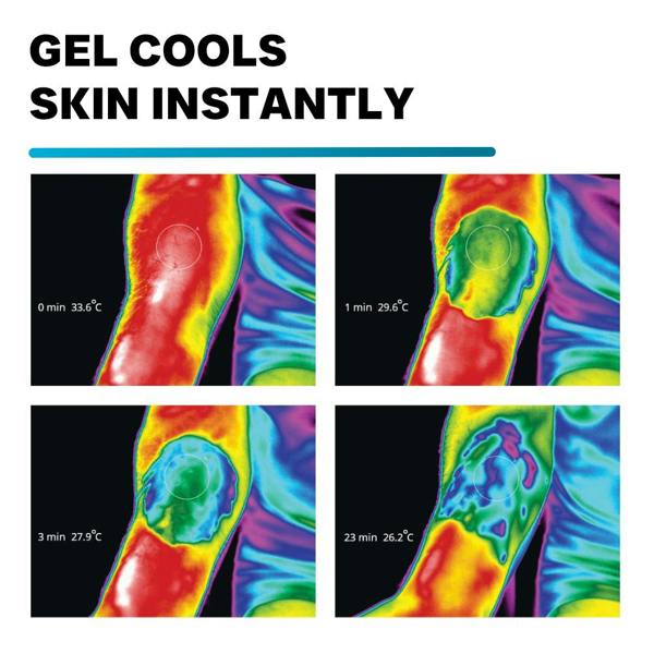 Biofrost Relief Features