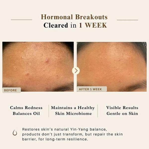 LUWIN Skincare Advanced Clear & Brightening Super Set – Acne & Dark Spot Routine for Clear, Even Skin | LUWIN