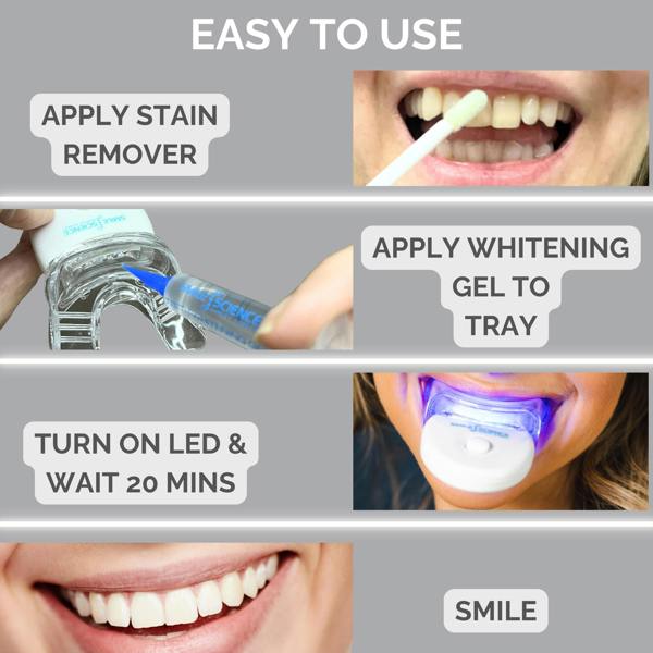 Smile Science Harley Street Professional Teeth Whitening Kit