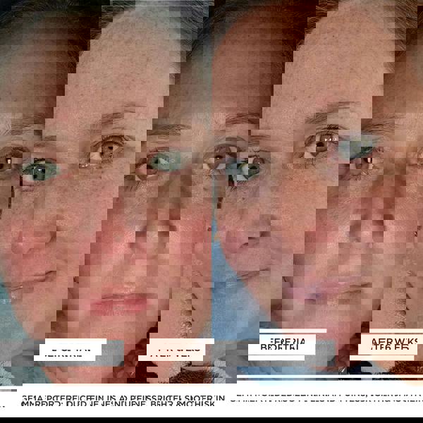 BeautyPro Tools & Accessories Photon Wand - Additional 7