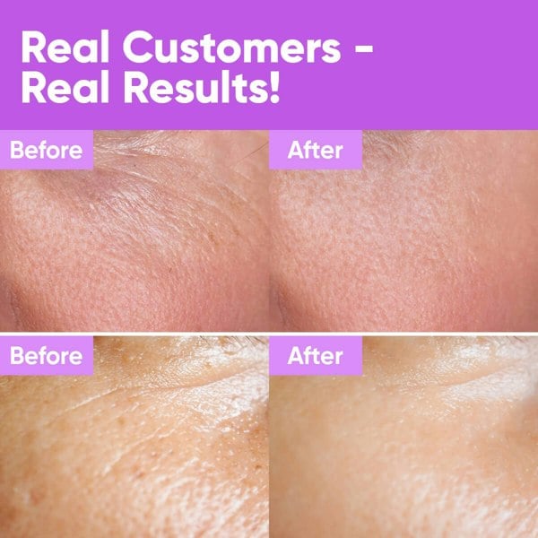 Âme Pure YOUTH CONCENTRATE – Face Serum With 42% Actives, Hyaluronic Acid, Anti-Aging