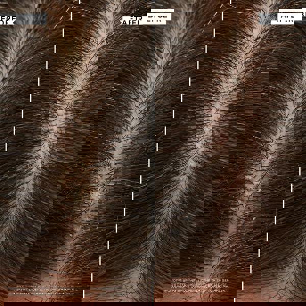 Philip Kingsley Flaky/Itchy Scalp Hydrating Curl Anti-Dandruff Shampoo 75ml - Additional 4