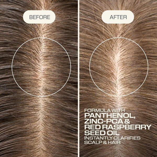 Goldwell Goldwell Dualsenses Scalp Specialist Clarifying Shampoo 250ml 250 ml