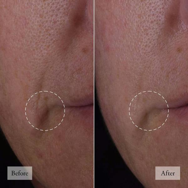 philosophy Serums & Treatments Dose of Wisdom Bouncy Skin Reactivating Serum 30ml - Additional 2