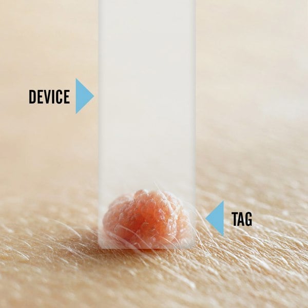 Tagcure PLUS Device Kit & Tagcure PLUS Top Up Pack