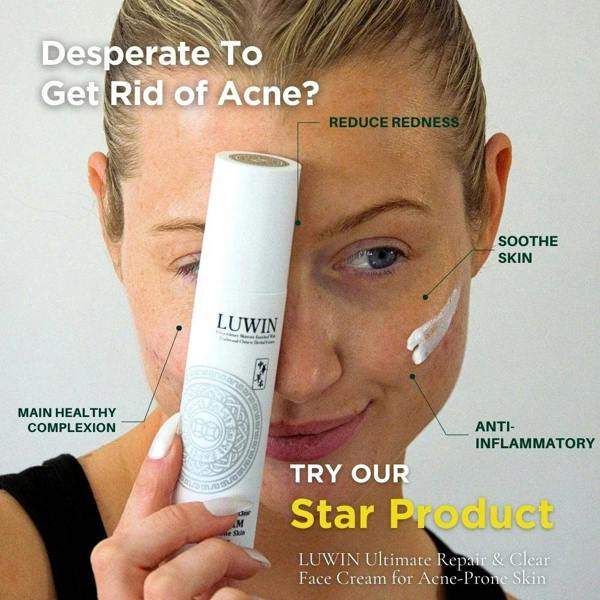 LUWIN Skincare Ultimate Repair & Clear Face Cream – Calming Acne Cream for Acne-Prone Skin | LUWIN