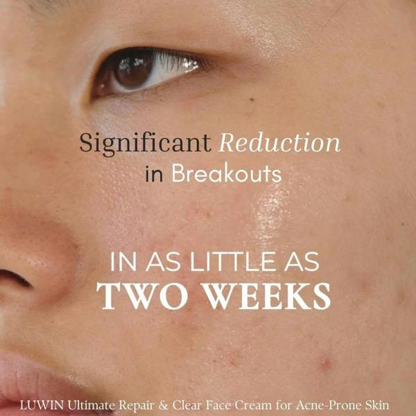 LUWIN Skincare Advanced Clear & Brightening Super Set – Acne & Dark Spot Routine for Clear, Even Skin | LUWIN
