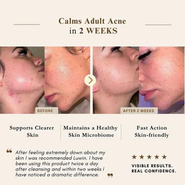 LUWIN Skincare Advanced Clear & Brightening Super Set – Acne & Dark Spot Routine for Clear, Even Skin | LUWIN