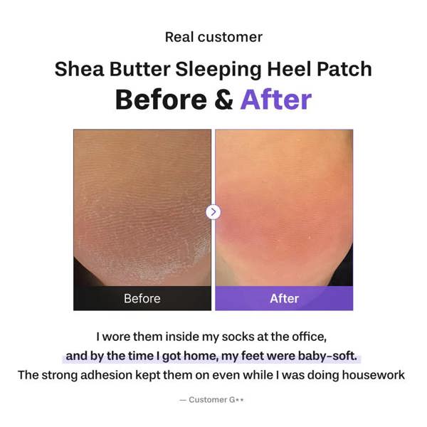 BAREN Shea Butter Sleeping Heel Patch 10pcs