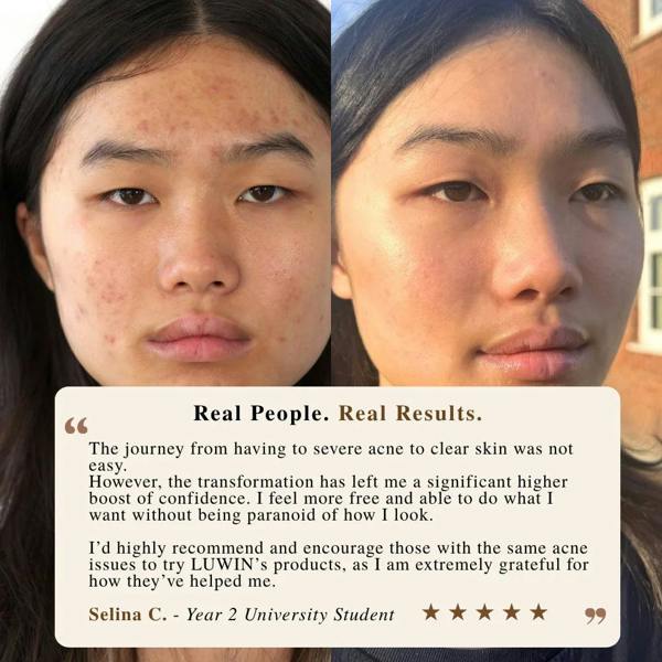 LUWIN Skincare Advanced Clear & Brightening Super Set – Acne & Dark Spot Routine for Clear, Even Skin | LUWIN