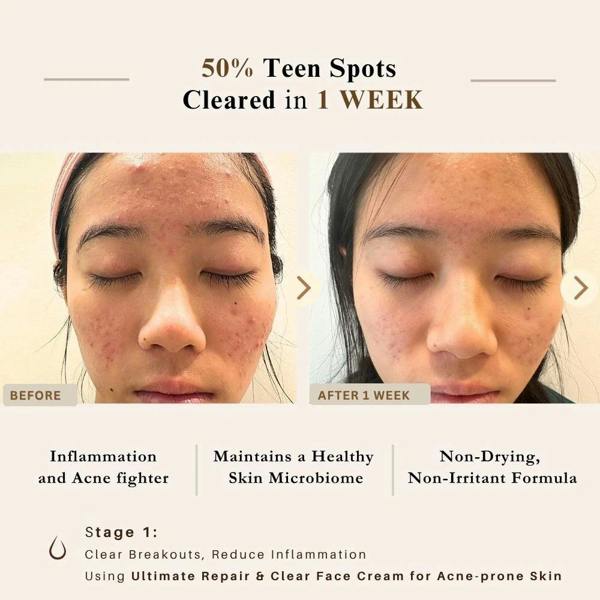 LUWIN Skincare Advanced Clear & Brightening Super Set – Acne & Dark Spot Routine for Clear, Even Skin | LUWIN