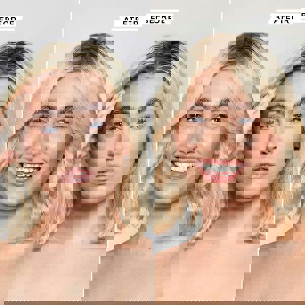 Philip Kingsley Conditioner Flaky/Itchy Scalp 1000ml - Additional 6