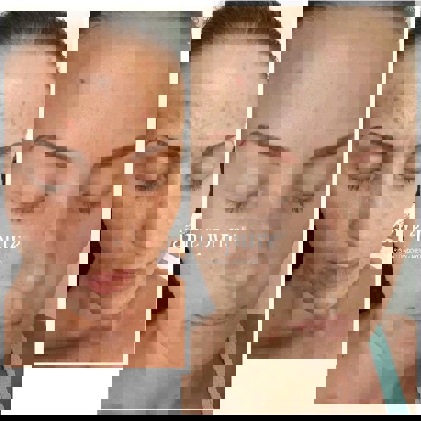 Âme Pure CIT FACE ROLLER PLATINUM - Microneedling Derma Roller Kit