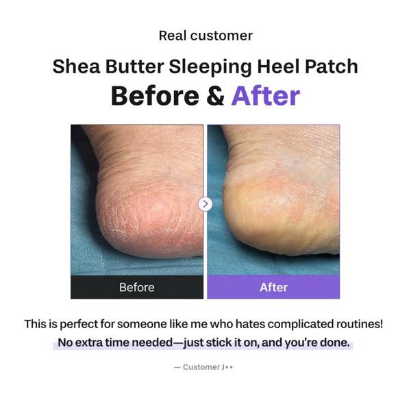 BAREN Shea Butter Sleeping Heel Patch 10pcs
