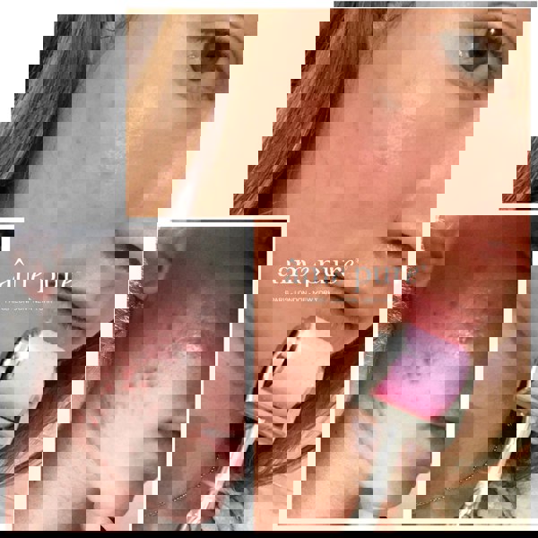 Âme Pure CIT FACE ROLLER PLATINUM - Microneedling Derma Roller Kit