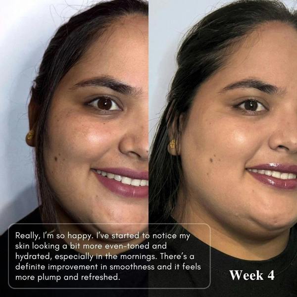 LUWIN Skincare Powerful Brightening & Rejuvenating Duo – Hyperpigmentation Cream & Brightening Serum Set | LUWIN