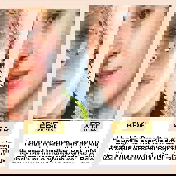 UpCircle The Pamper Kit