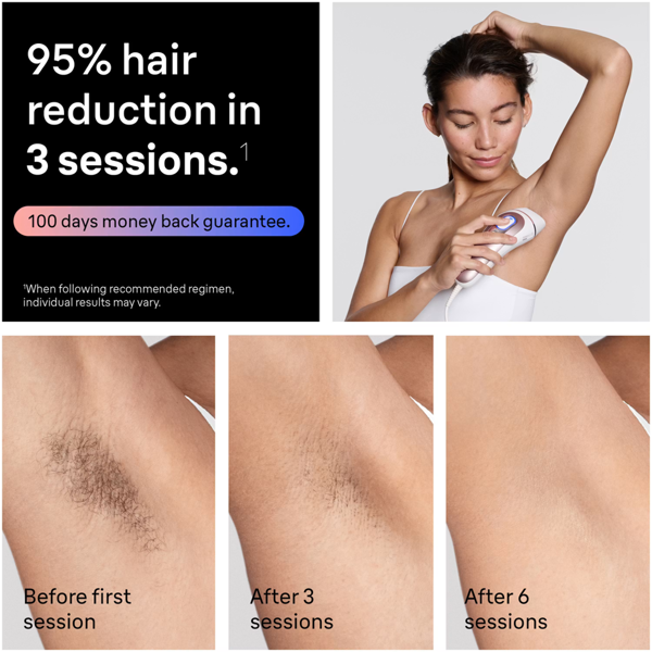 Braun Smart IPL Skin i·expert, At Home Hair Removal, With Free App, 2 Smart Heads, PL7211