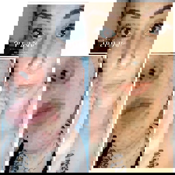 Âme Pure CIT FACE ROLLER PLATINUM - Microneedling Derma Roller Kit