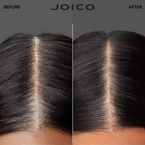 Joico Scalp Vitality Replenishing Essence Duo