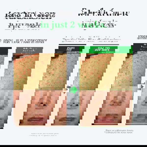 Dr.Althea  Gentle Vitamin C Serum 30ml - Additional 3