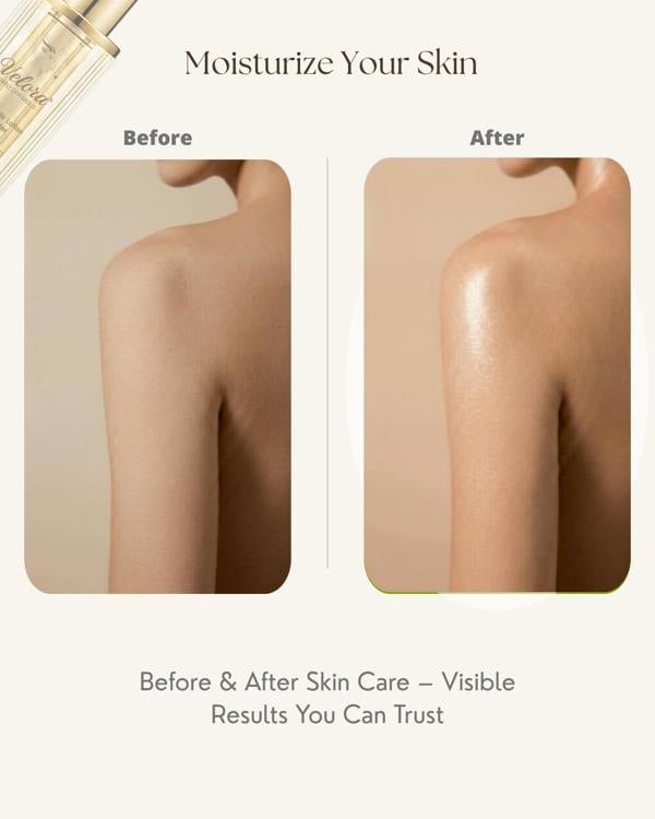 Before and after skin care comparison showing a woman's shoulder and upper back, after using Velora Goat Milk body lotion that moisturises the skin totally