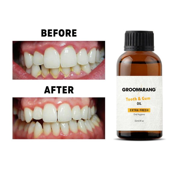 Groomarang Extra Strength Tooth & Gum Treatment Oil 15ml