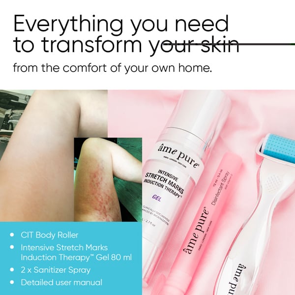 Âme Pure BODY BASIC | STRETCH MARKS – Microneedling Derma Roller Kit For Cellulite & Stretch Marks